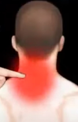 Chiropraktyczne Rozywiązania na ból szyi Chiropraktyczne Rozywiązania na ból szyi